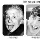 [Health Trend] 일할때 실수많고 자주 `버럭` 하면? 성인 ADHD 의심을 이미지