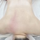 명지오션시티동물병원 | 명지 오션 화문에스테틱 수상경력다수인 원장님에게 받은 어깨 등관리 후기