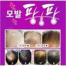 큐사랑 이미지