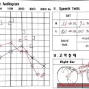 포낙보청기 남포센터 이미지