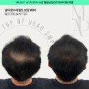 예쁜민낯