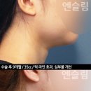 볼독