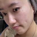 [내돈내산] 톰프로그램 소개 및 실제 사용후기(3회차)