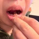 (주)케이씨메디 | [먹는장미오일 4주 후기]붉은기·트러블 예민피부 솔직 기록