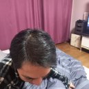 동서제일의원 | 당진 합덕 탈모의성지 합덕제일의원 #두달후기 #리얼후기