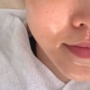 에스프라자 | 청당동 에스테틱 우아에스떼에서 인생 첫 피부관리 받은 대만족 솔직 후기!