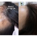 수기헤어 이미지