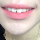 어딕션 이미지