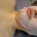 월드컵로(마포구청역~합정역) | [성산동 피부관리] 이모아에스테틱 합정역 윤곽관리 솔직후기