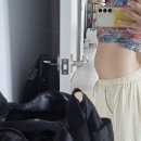 연세사랑모아 여성병원 자궁근종 로봇수술 후기 2탄 수술편
