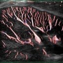 메디컬에디션 이미지