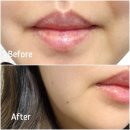 아워글로벌 | 립밤추천 이민정립밤 아워스킨 각질 완벽 케어 립밤 후기