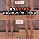 격동초등학교 | 여름 대비 부종 많은 하체 집중 관리 울산 은에스테틱 솔직 후기