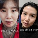 단아인셀덤