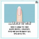 손톱모양