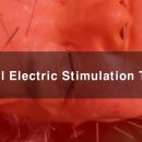 전기침을 이용한 미용과 치매 개선효과 이미지