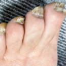 새튼튼약국 | 로세릴 네일라카 가격 프라이머 에센스 병행 사용방법 후기