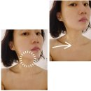청담동에스테틱 김윤정의YJ스파 청담점 페이스 리프팅 케어 후기