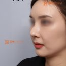 에스에이치(SH)성형외과의원 이미지