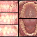 e가지런한치과의원 이미지