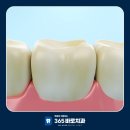 새하얀미소치과의원 네이버블로그