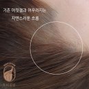 두피공방헤어라인