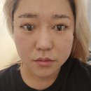 오로라 뷰티 | 춘천피부관리 뷰티오로라엘본점 윤곽관리 받은 후기 춘천웨딩관리 추천