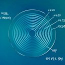 광양안경-성장기 아이 시력, 이렇게 지키세요! 근시억제렌즈 리얼후기 공개&lt;스텔리스트&gt;