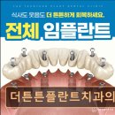 더튼튼플란트치과의원 네이버블로그