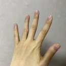 더리온