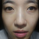 미도테라피 이미지