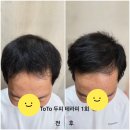 이복순 | 평택 이복순 원장 다윤헤어 탈모관리 고수 찐후기