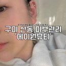 에이원케어메디컬 | 구미 산동 피부관리 즉각적인 변화 벨로체 고주파 리프팅 후기 에이원뷰티