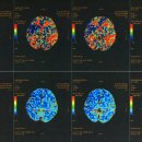 뇌움한의원 이미지