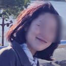 주식회사 다볼 | 관양동 슈링크 리프팅으로 탄력 관리하고 온 솔직 후기 + 홍조 레이저