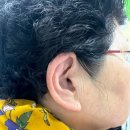 독일보청기 태평센터 | 할머니 새해맞이 보청기 교체, 성남보청기 독일보청기 태평센터 방문 후기