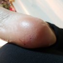 발뒤꿈치각질 “닥터씨 발각질제거기” 진심 개쩌는 후기