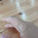 손가락통증으로 인한 병원 후기 삼성튼튼마취통증의학과 다녀온 후기