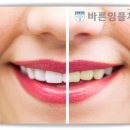 더바른치과기공소 이미지