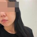 부산쥬베룩 3주-1달차 미치게 만족한 사람 후기