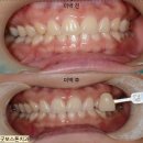 미소가있는보스톤치과의원 | 김해 어방동 치아미백, 30년 경력 굿보스톤치과에서 환하게 웃으세요!
