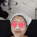 광주 최초 닥터밸루 합법레이저 엑스터 여드름 흉터 기미관리 설브광주화정점