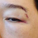 대청병원 | 대전 용전동 아이엠닥터스미 성형외과 방문후기/대청병원 신경외과 진료 후기