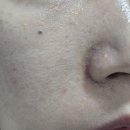 베이직바디 | 인천피부관리 아뜨레블랑 스킨&amp;바디 베이직케어 후기