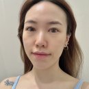 베니히룸