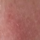 더리버피부과의원 이미지