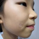 (주)마이크로컨텍솔루션 | 여드름패치 아르페 트러블케어 엑스퍼트 마이크로팁 패치 솔직후기