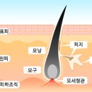 일러스라인 이미지