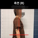 대동한의원 | 골반 틀어짐 신도림마사지 체형교정마사지로 해결! 신도림 골반교정 제대로 받고 온 후기