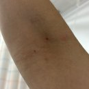 (주)회진유통 | 성인 급성 장염 3박4일 (이길바라는) 입원 후기..